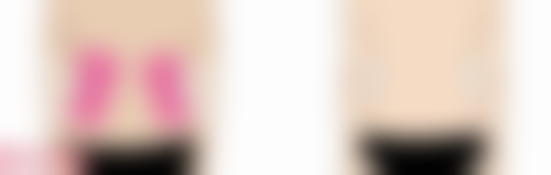 六、深圳港龙医院私密赵灿灿医生口碑评价及真人实例反馈