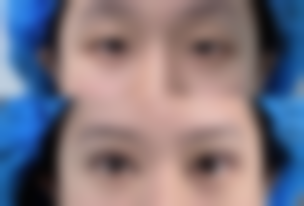 六、新疆梁青松整形美容医院口碑如何？