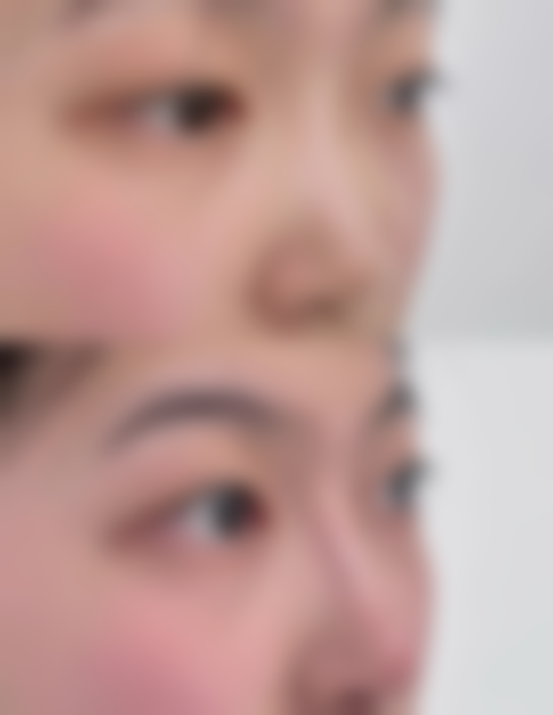 疤痕子宫怎么来的？剖宫产、肌瘤剔除术等多种手术及腹部创伤，都可能是其成因！ 