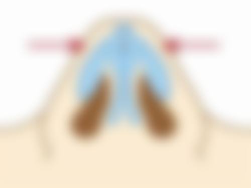 四、宿州惠尔美整形美容李孟华医生坐诊医院