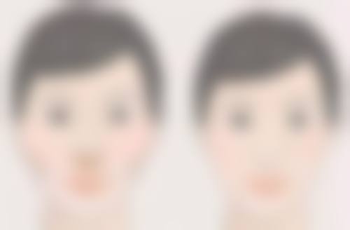 不同眼袋类型适配情况大不同