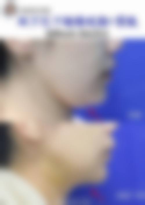 四、无锡市扬名整形美容中 心特色项目