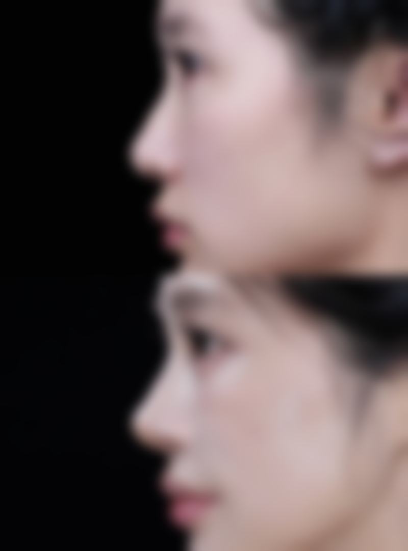 六、济南美莱医疗整形美容医院口碑如何？