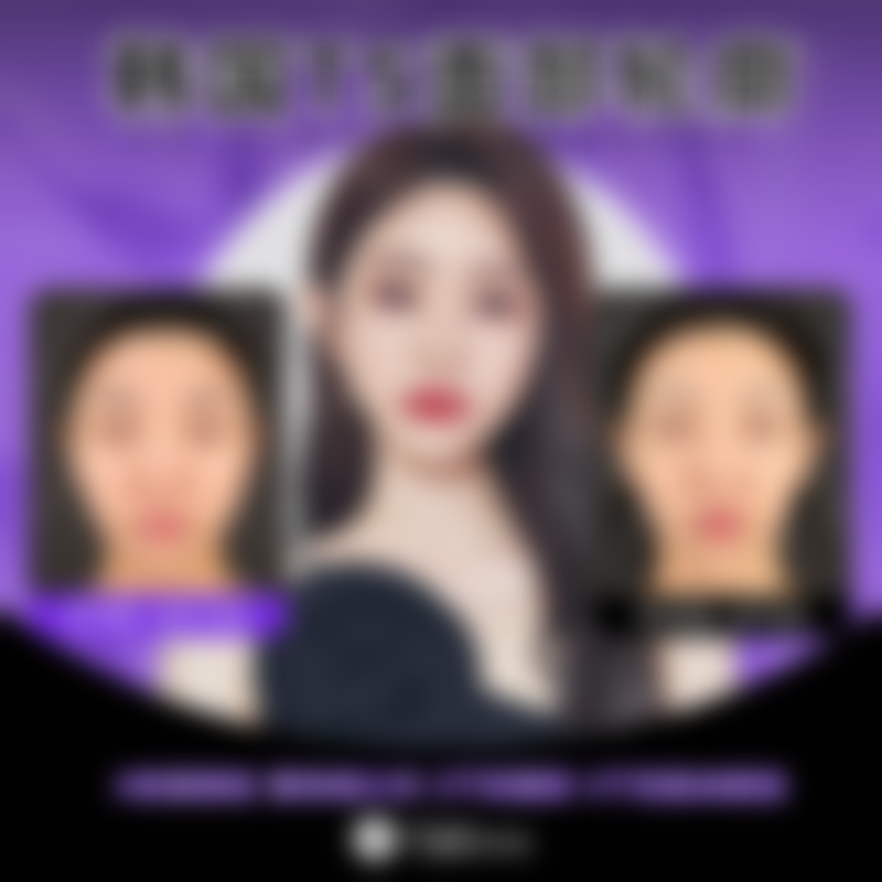 四、韩国TS整形外科特色项目