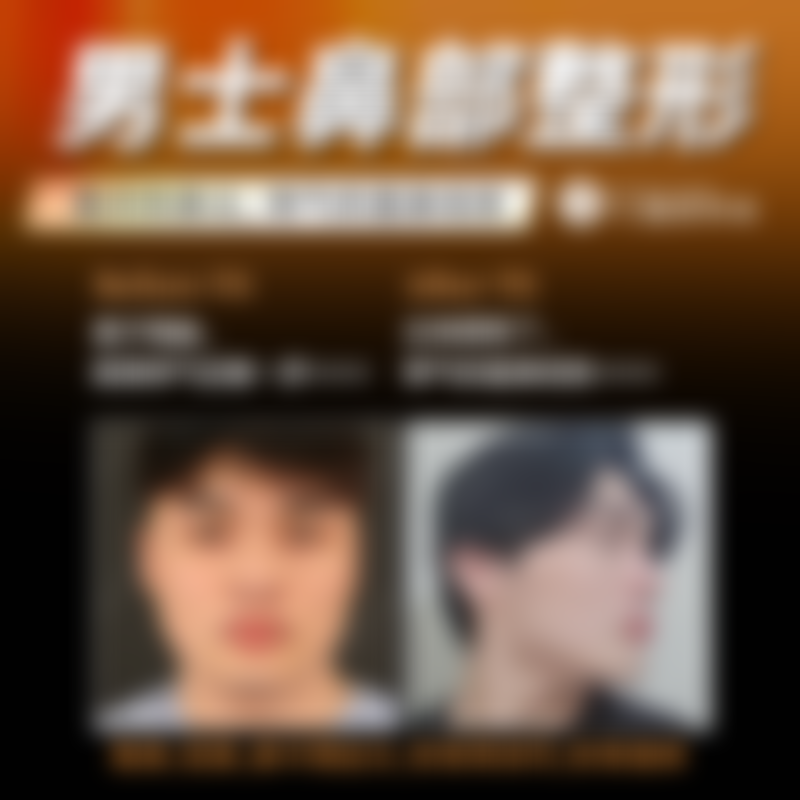 八、韩国TS整形外科怎么预约？