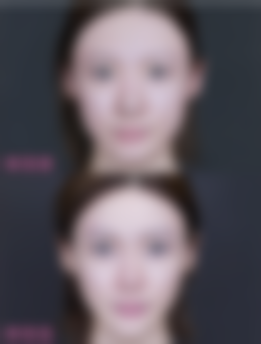 微整注射或成拿手好戏