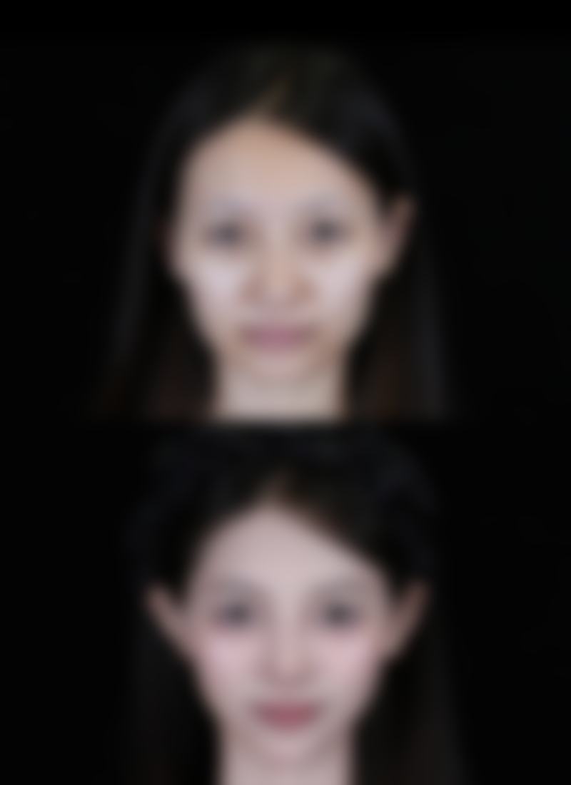 七、成都科思研医学美容赵泽方医生怎么预约？