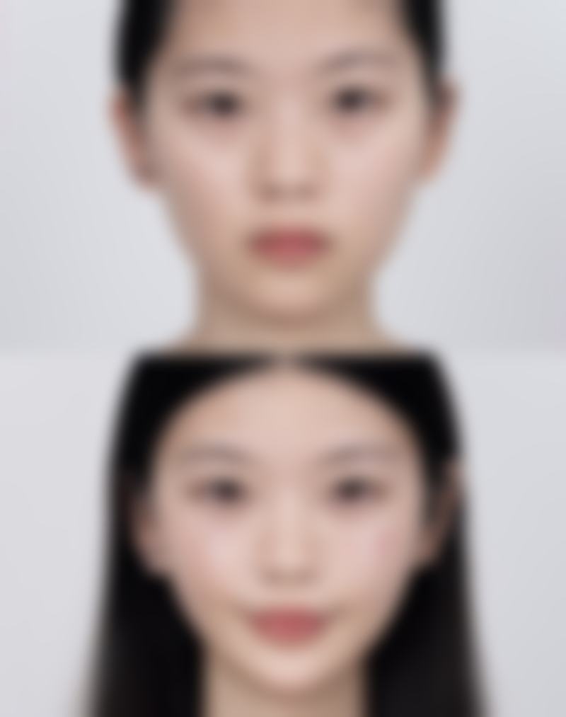 六、深圳港龙医院私密顾亚谋医生口碑评价及真人实例反馈