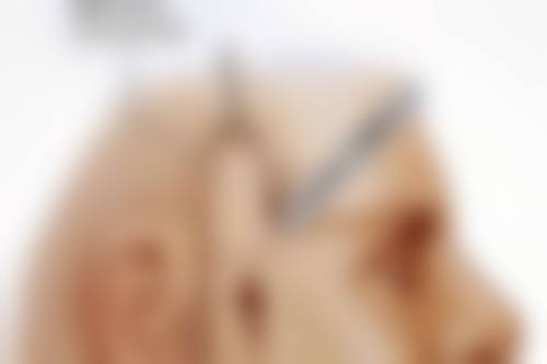 五、曹倍正医生技术怎么样？