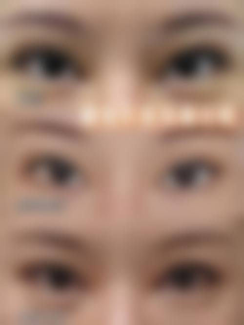 五、常州美之术医疗美容诊所收费价格表