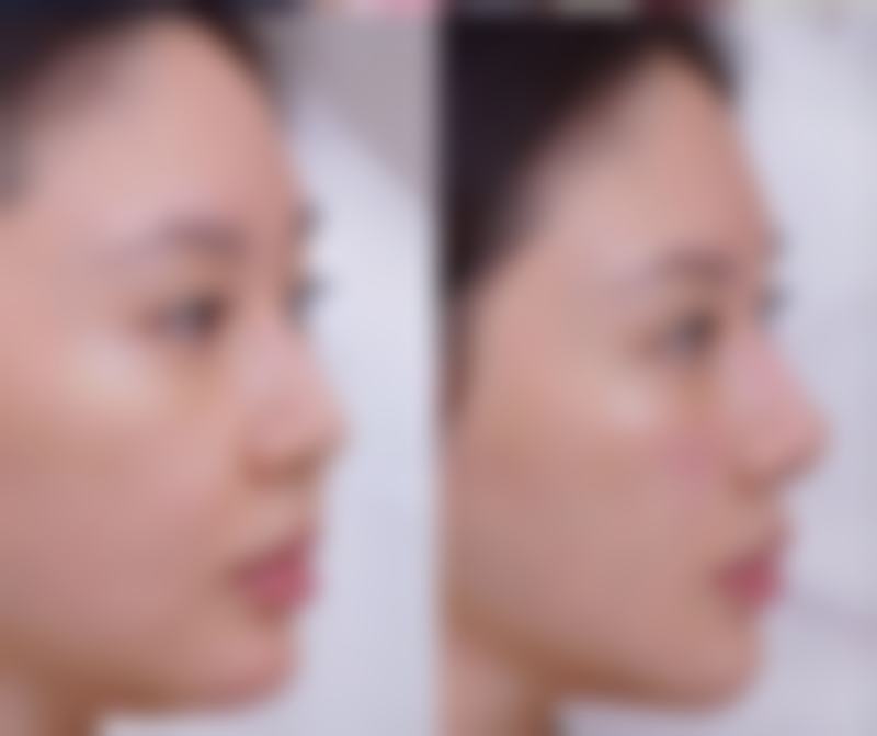 六、秦皇岛铧中医疗美容门诊部口碑如何？