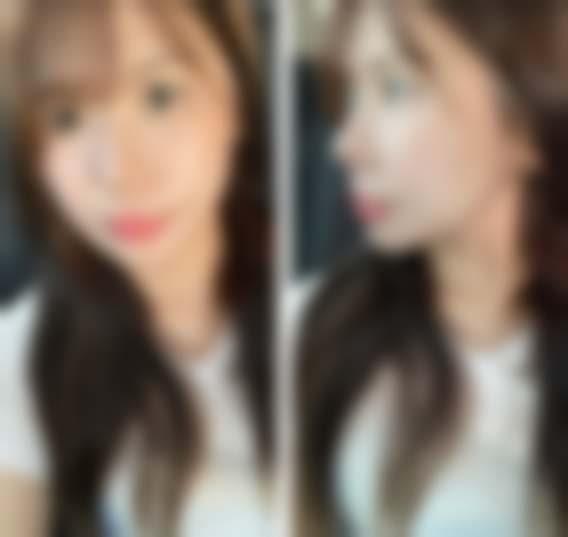 四、太原婧妍科美医疗美容诊所特色项目