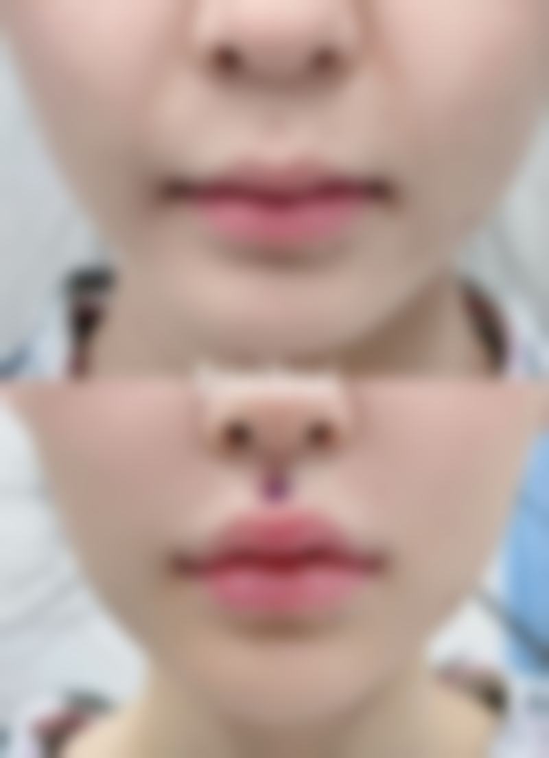 眼部护理，呵护眼周肌肤