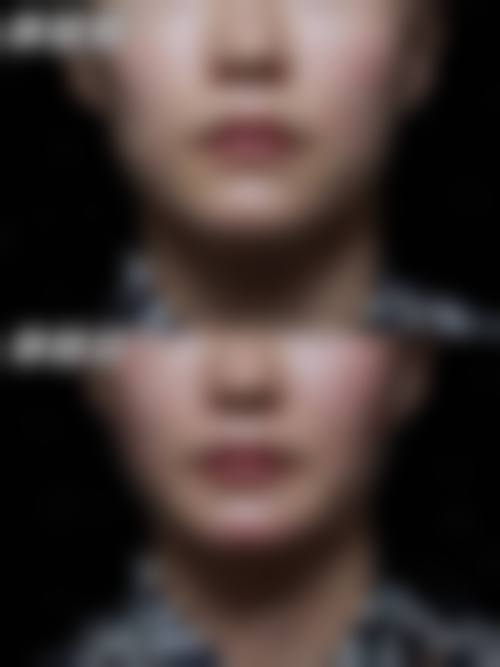 六、天津医 科 大学第二医院(整容与医疗美容科)口碑如何？