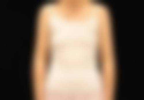 四、怀化久喜医疗美容诊所特色项目