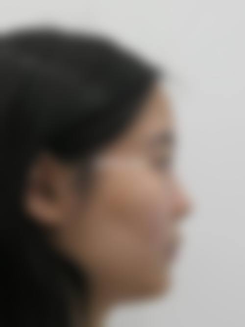 四、沈阳云惠美医疗美容特色项目