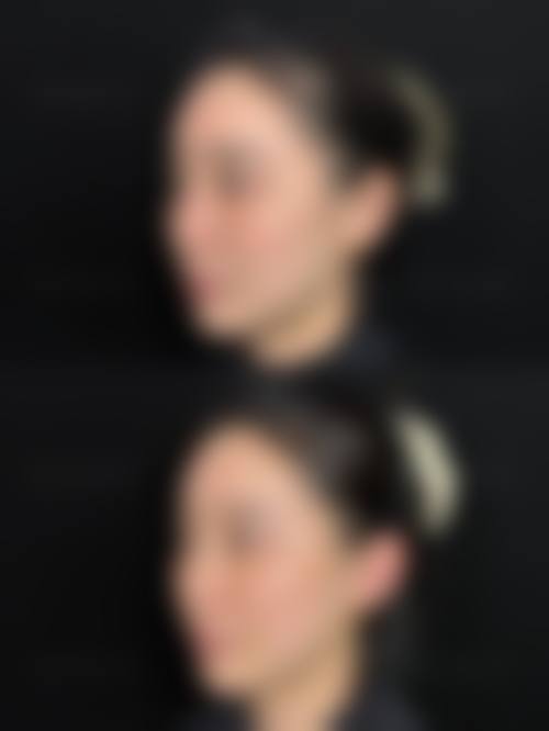 五、广州大医汇医疗门诊部医疗美容科收费价格表