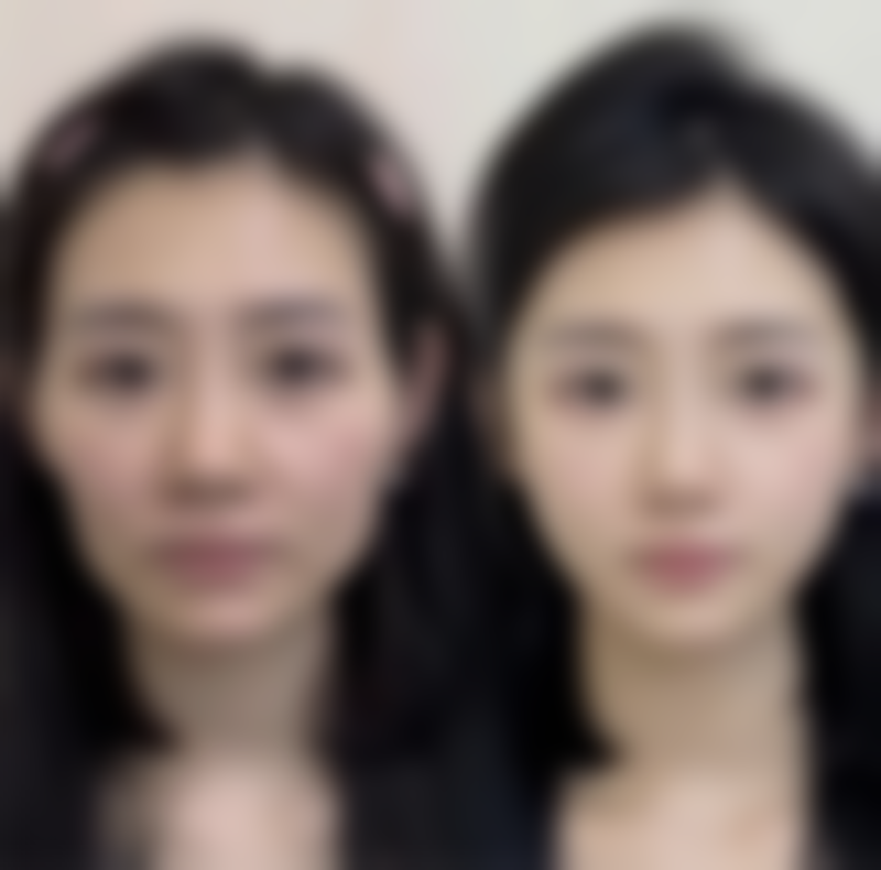 就医后的专精治疗措施