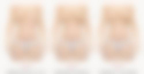 护理不当导致多层双