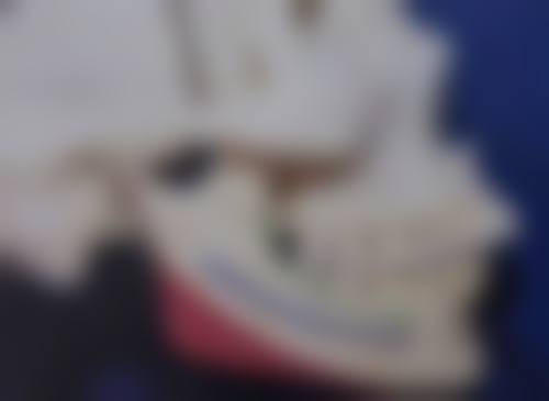 埋线双眼皮出现了多层双是怎么回事？或因短期肿胀、护理不当，也可能是长期缝线问题及皮肤变化！ 