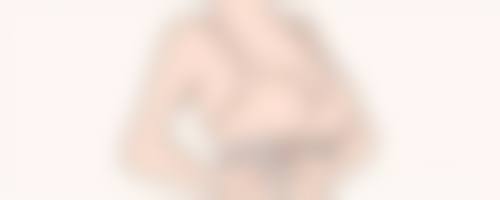 切眼袋多长时间能恢复好啊？恢复时间与手术方式等有关，一般1 - 6个月可完全恢复！ 