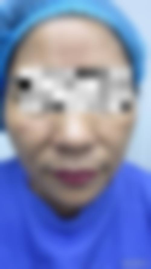 五、青岛壹可医研医疗美容诊所收费价格表