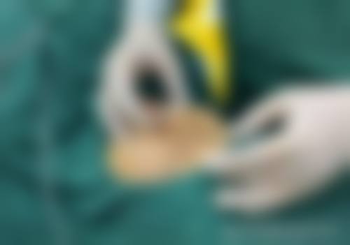 四、青岛壹可医研医疗美容诊所特色项目