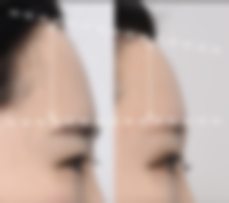 八、嘉兴臻颜整形医院怎么预约？