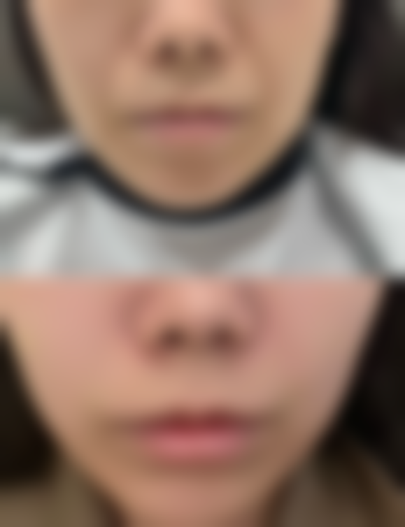 五、嘉兴臻颜整形医院收费价格表