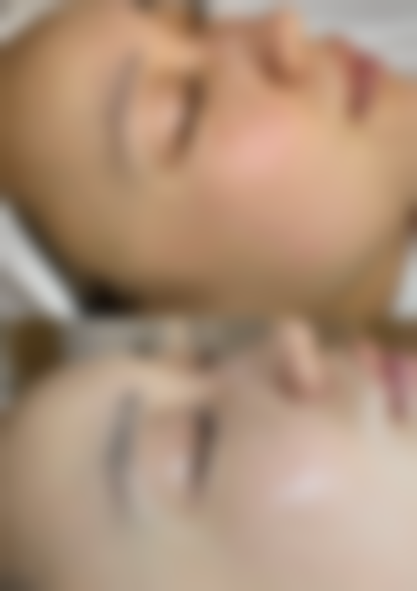 术前评估的重要性