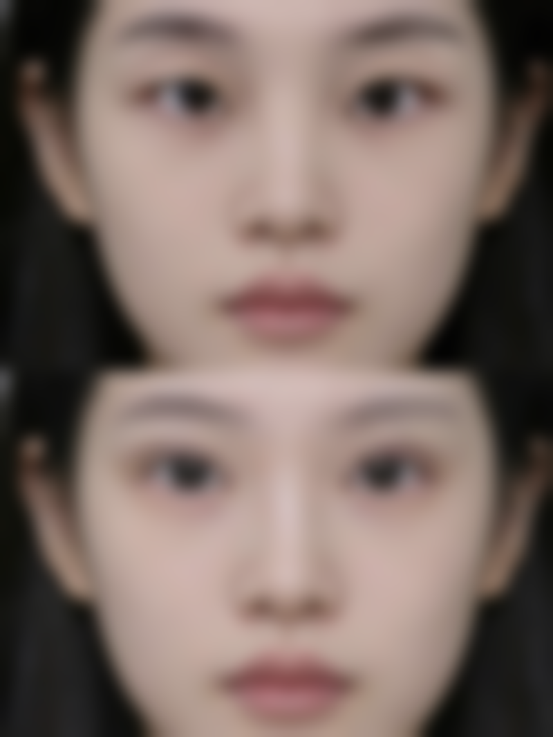 六、成都科思研医学美容赵泽方医生口碑评价及真人实例反馈