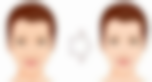 红霉素软膏可以祛眼袋吗？权威医生称无科学依据，仅能抗菌，无法解决结构性问题！ 