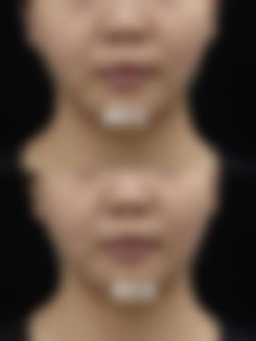 五、杭州优医联合医疗美容诊所收费价格表