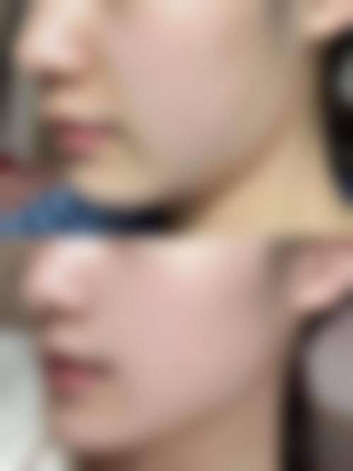 六、杭州优医联合医疗美容诊所口碑如何？