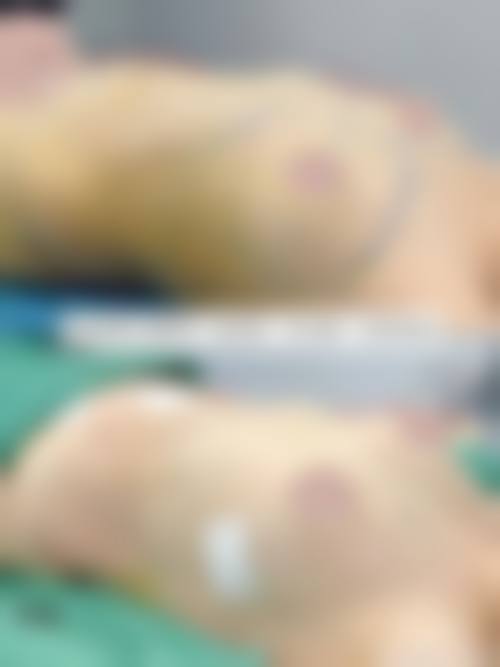 四、成都美壹典零零壹医疗美容门诊部特色项目