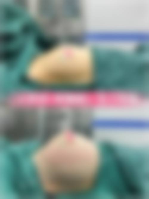 八、广州雅丽达医学美容怎么预约？