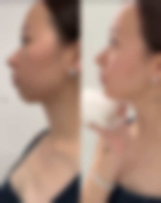 五、淮安市第二人民医院烧伤整形科收费价格表