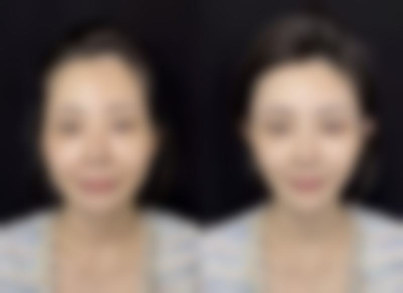 七、广州古汀医疗美容何兴鹏医生怎么预约？