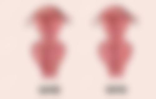 硅酮凝胶：物理屏障防疤痕