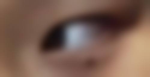 五、烟台莱阳中 心医院烧伤整形武永春医生技术怎么样？