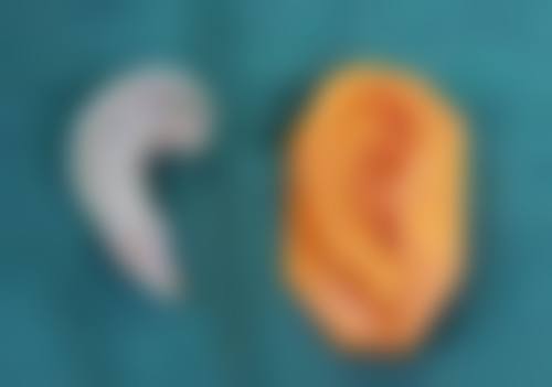 六、梅州曙光整形医疗美容医院口碑如何？