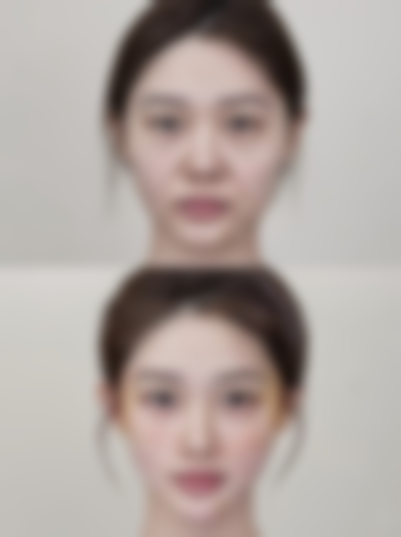 六、嘉峪关韩美尔整形陈志芳医生口碑评价及真人实例反馈