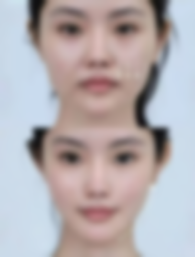 六、长沙禾丽医疗美容刘华荣医生口碑评价及真人实例反馈