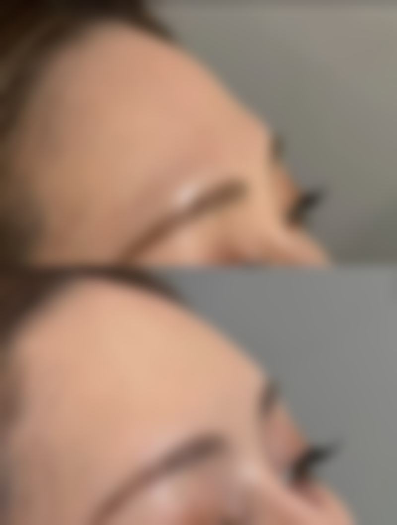 六、佰诺佰琪(巴诺巴琪) 。金柳廷医生口碑评价及真人实例反馈