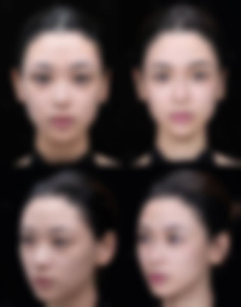 五、成都美极整形医疗美容门诊部收费价格表