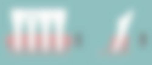 贴双眼皮贴的小技巧