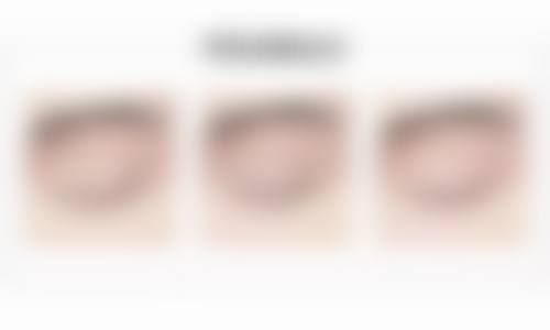 八、南昌优壹美医疗美容门诊部怎么预约？