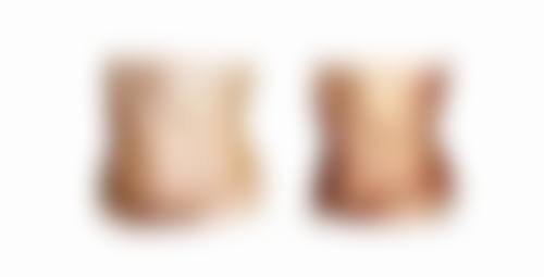 五、郑旻祐医生技术怎么样？