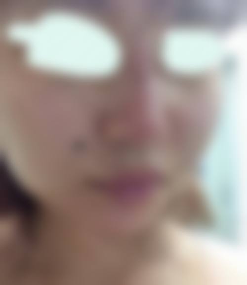 四、滕州恩顺医疗美容医院特色项目