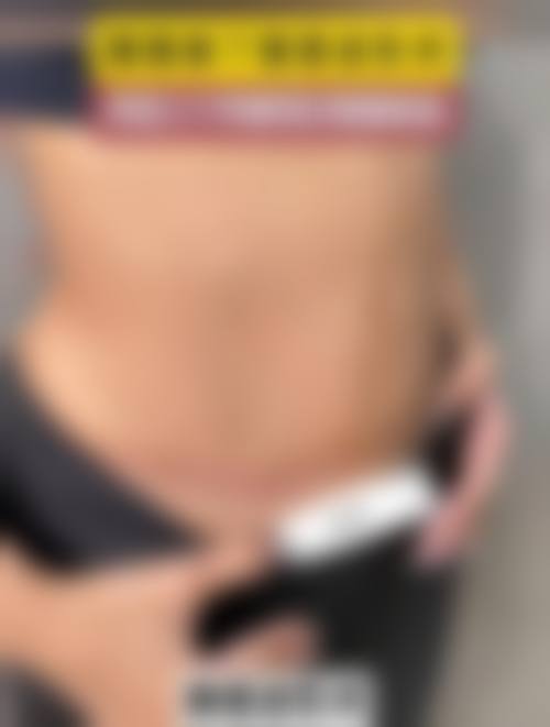 五、成都美懿美辰整形医院收费价格表